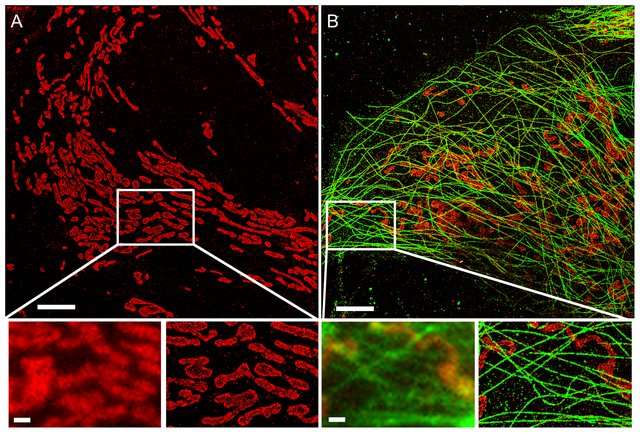 Super-resolution microscopy Image