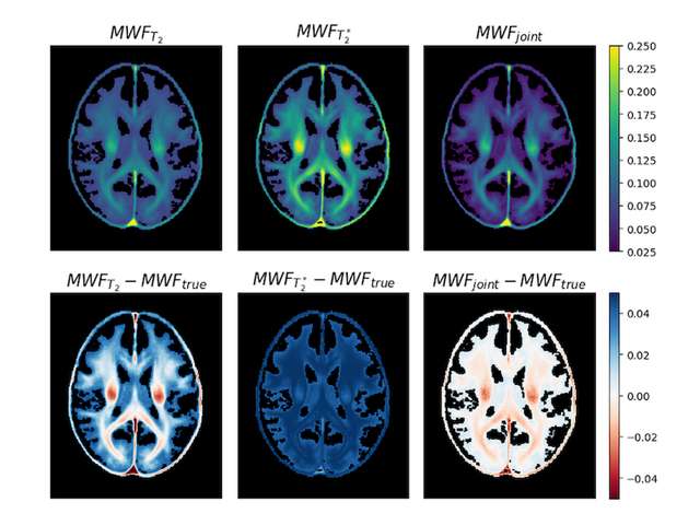 Joint Inversion for Accurate Brain Myelin Mapping Image