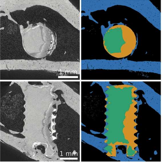 Synchrotron-radiation microtomography Image